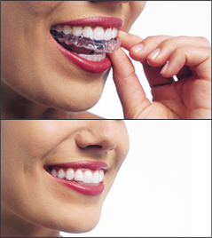 Centros Dentales Lucena Estepa Herrera - Montse Rojas - Ramn Luis Banchs - Dentista de Confianza - Invisalign