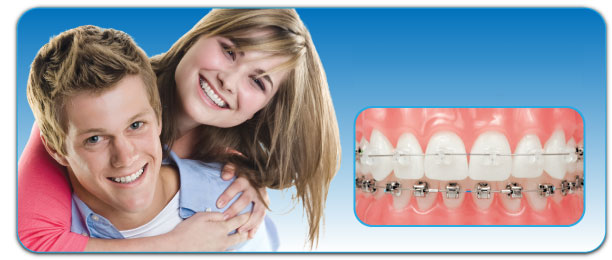 Centros Dentales Lucena Estepa Herrera - Montse Rojas - Ramn Luis Banchs - Dentista de Confianza - Aparato de dientes - Brackets