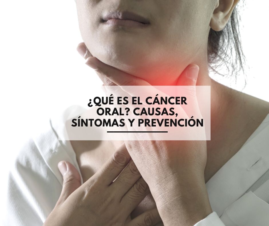 cancer bucal sintomas y signos